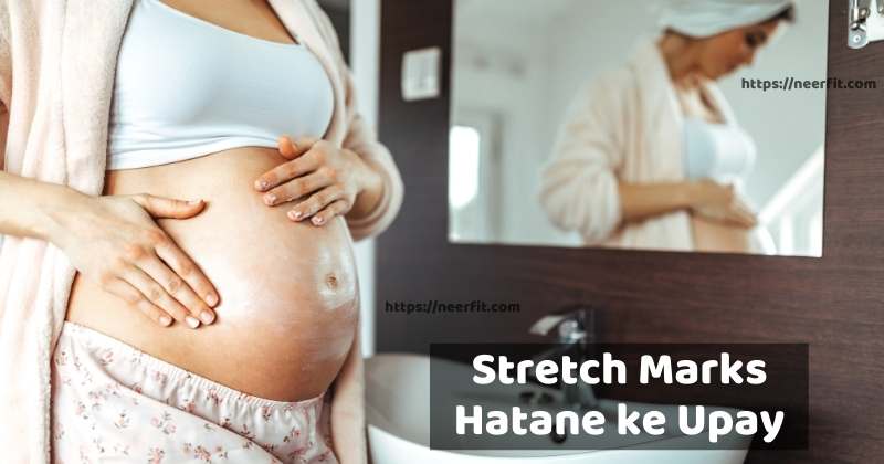 stretch marks hatane ke upay