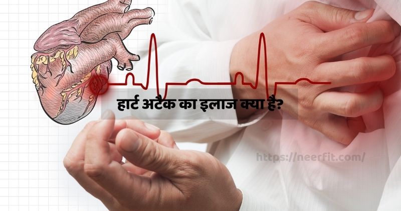 हार्ट अटैक का इलाज क्या है?